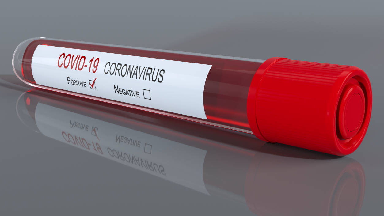 Positive Coronavirus Covid-19 Test 3D model