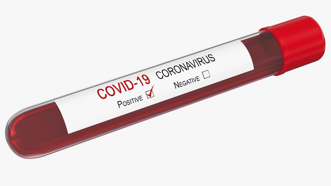 Positive Coronavirus Covid-19 Test 3D model