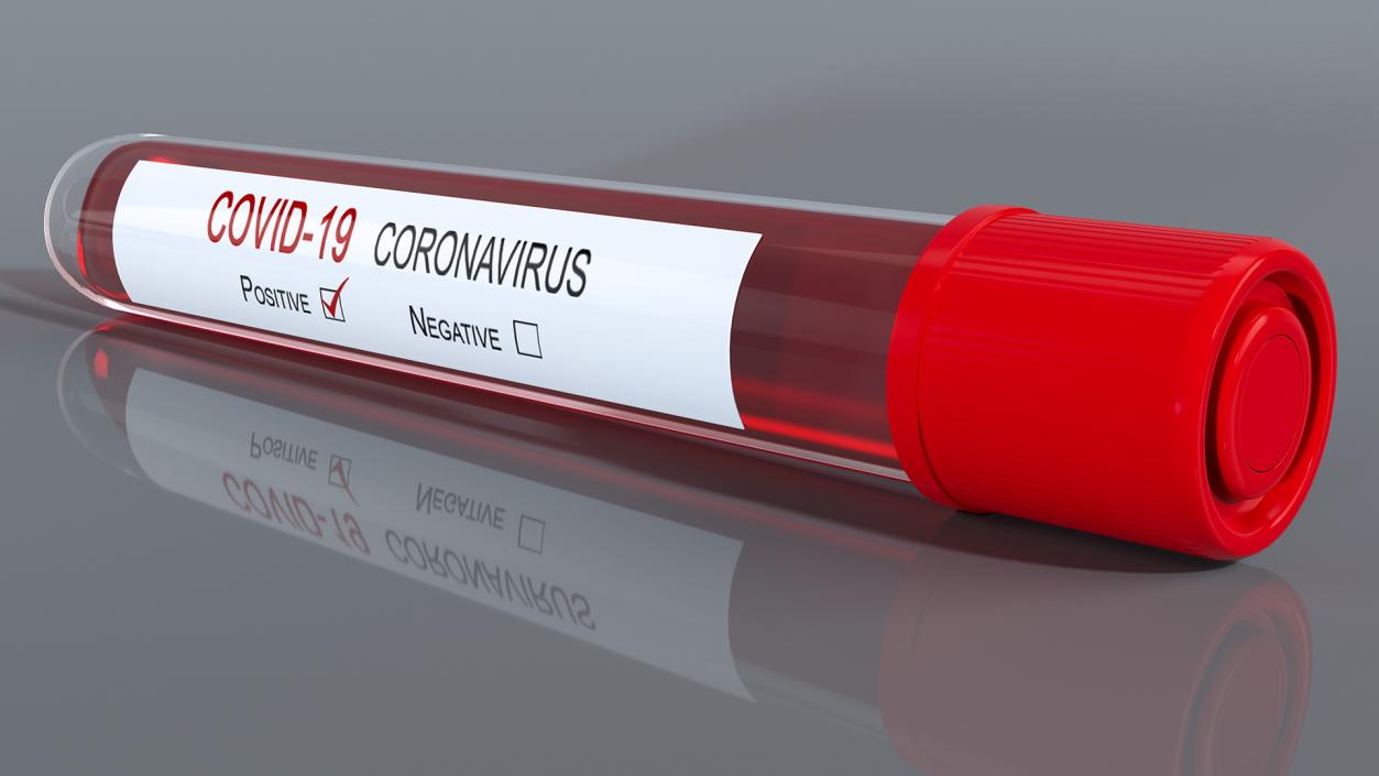 Positive Coronavirus Covid-19 Test 3D model