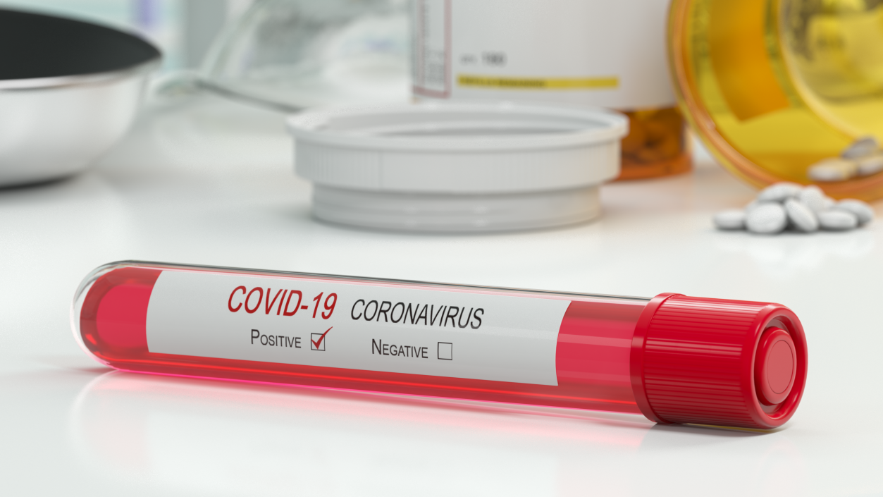 Positive Coronavirus Covid-19 Test 3D model