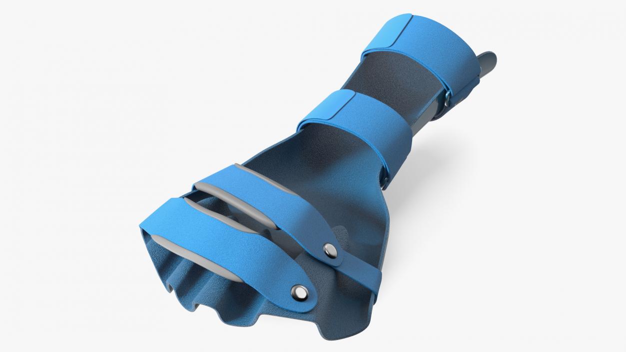 3D Blue Hand Orthosis with Fingers