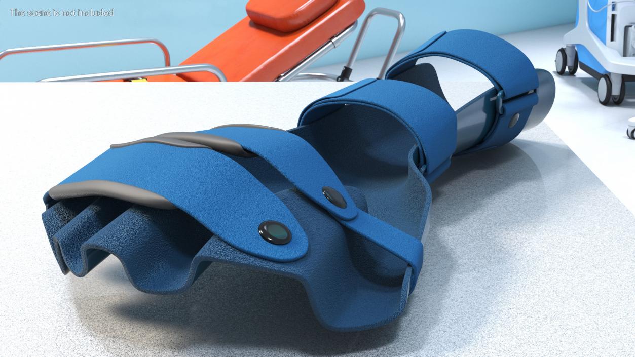 3D Blue Hand Orthosis with Fingers