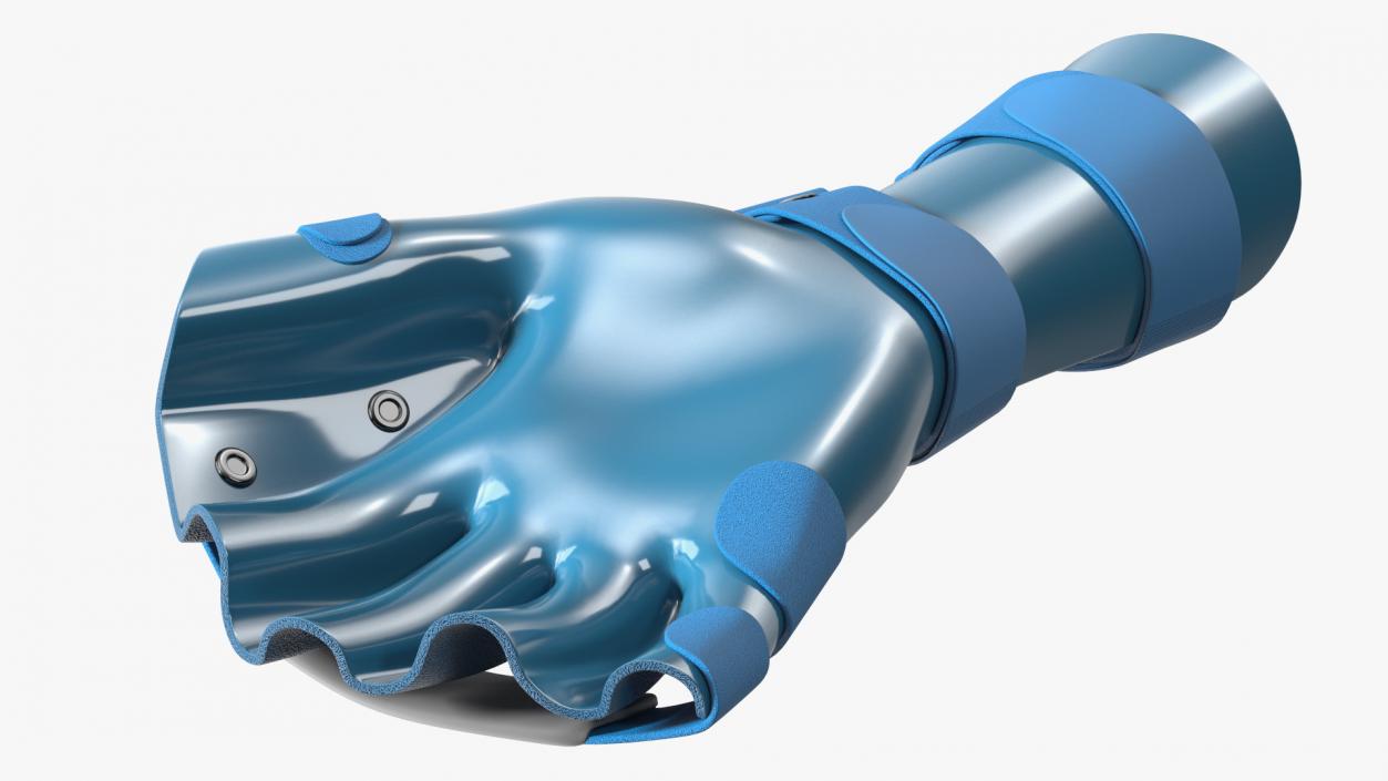 3D Blue Hand Orthosis with Fingers