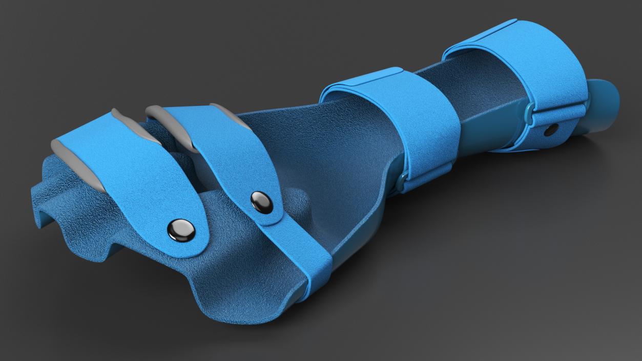 3D Blue Hand Orthosis with Fingers