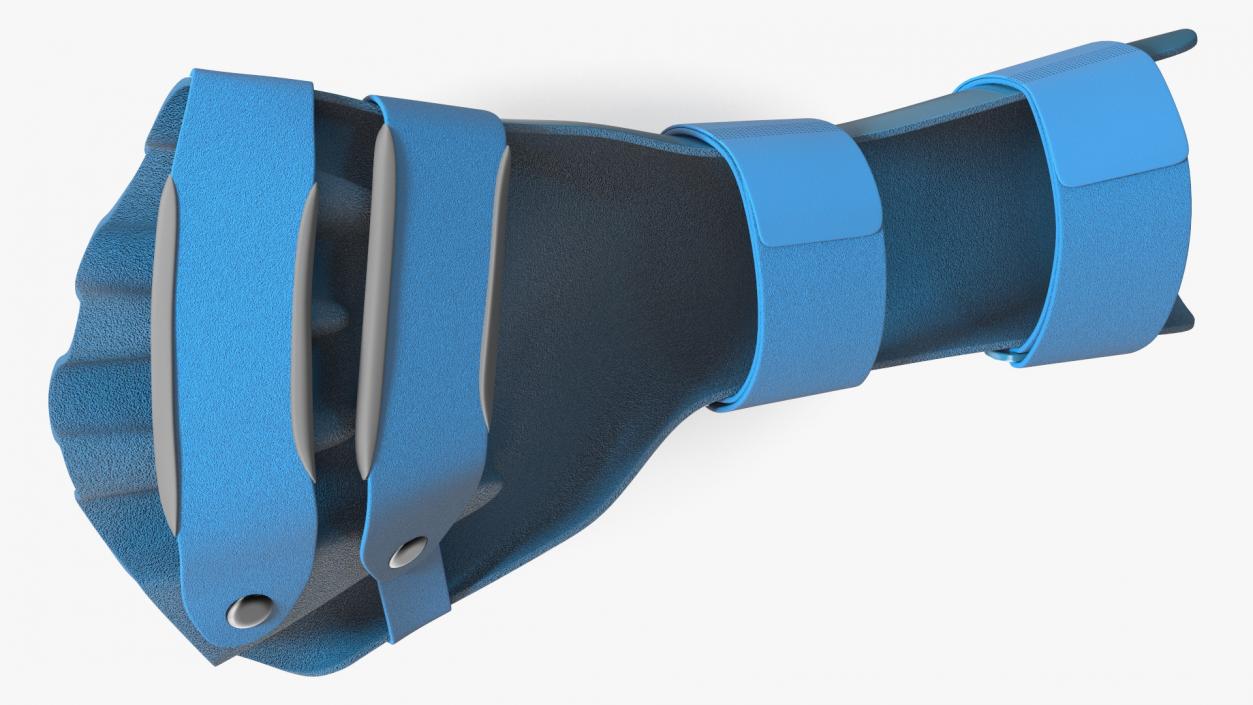 3D Blue Hand Orthosis with Fingers