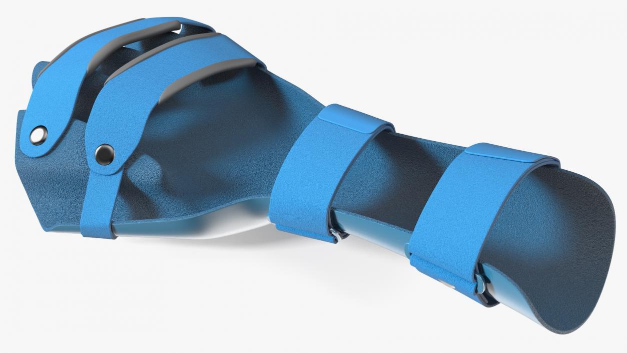 3D Blue Hand Orthosis with Fingers