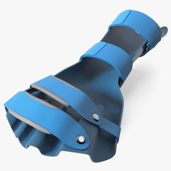 3D Blue Hand Orthosis with Fingers