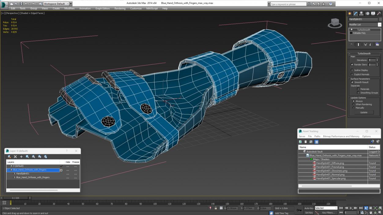 3D Blue Hand Orthosis with Fingers