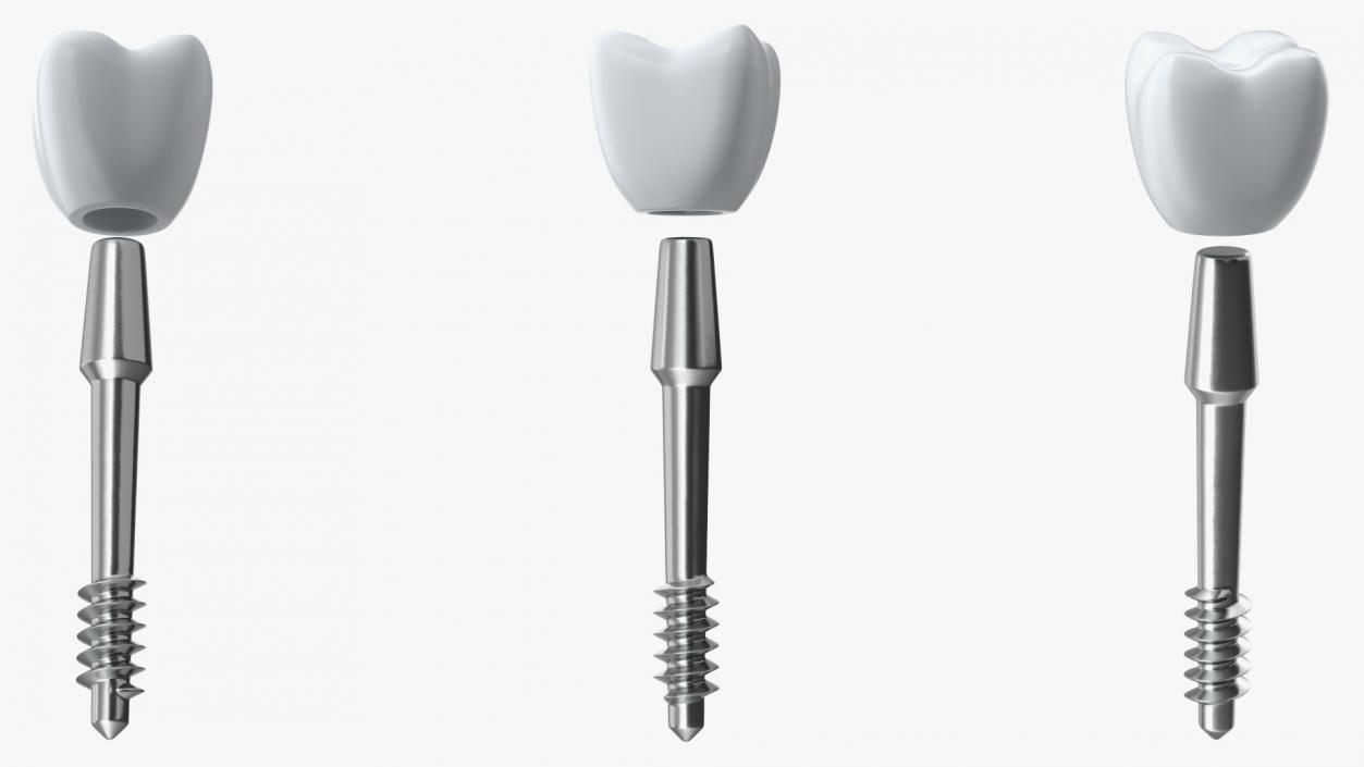 3D BCS Series Dental Implants 5 cm