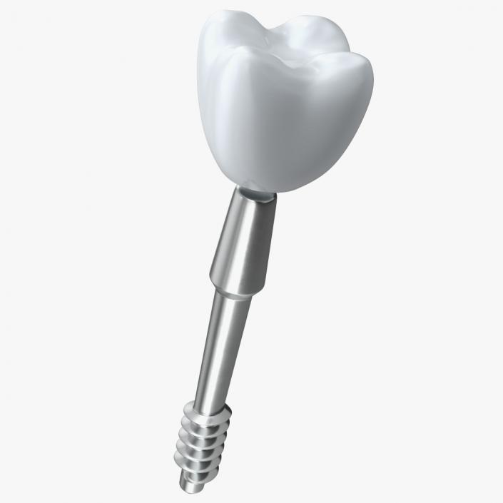 3D BCS Series Dental Implants 5 cm