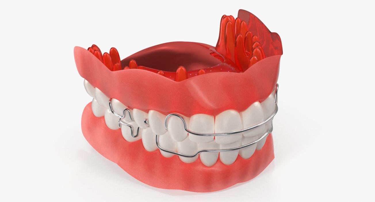 3D model Typodont Tooth Orthodontic Retainer