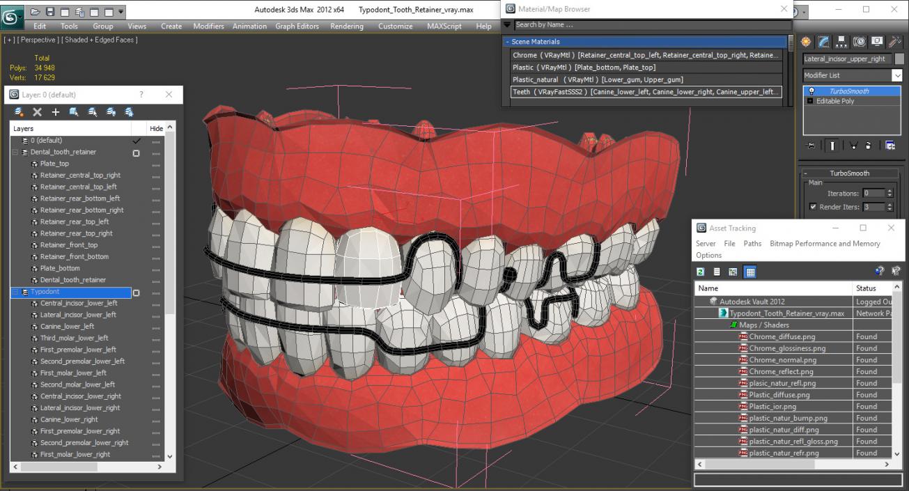 3D model Typodont Tooth Orthodontic Retainer