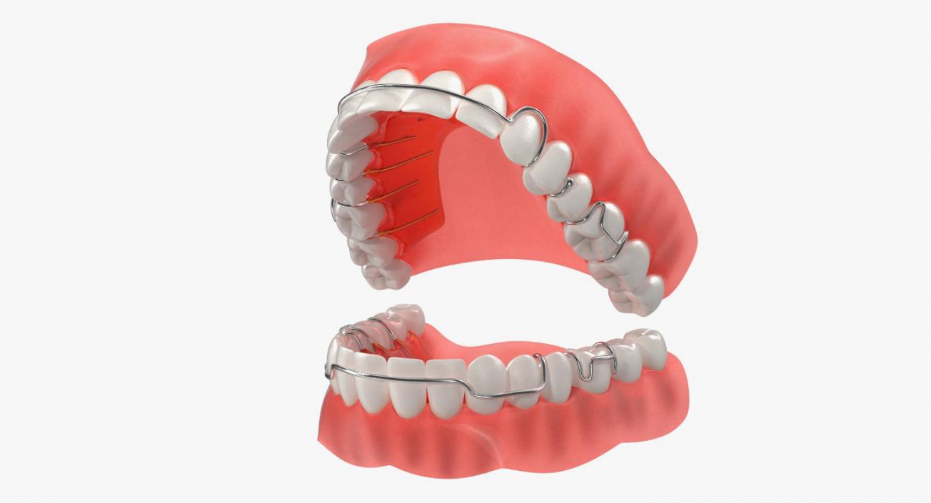 3D model Typodont Tooth Orthodontic Retainer