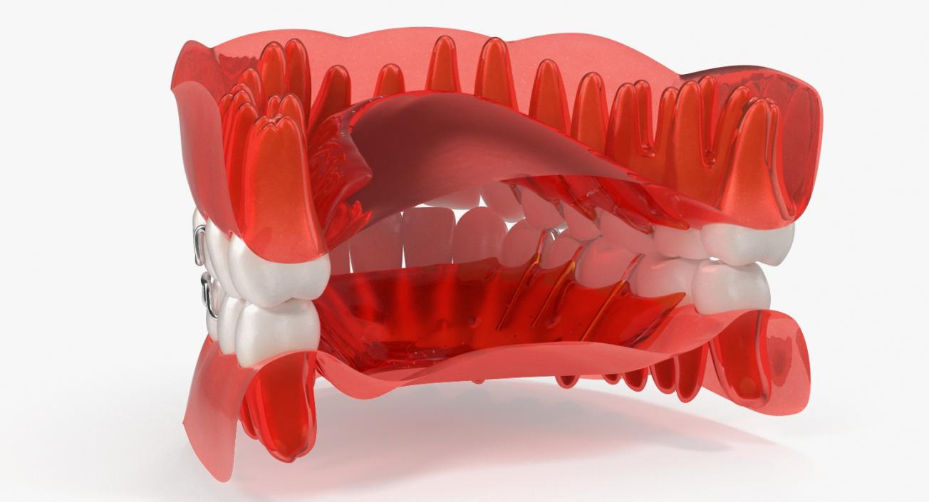 3D model Typodont Tooth Orthodontic Retainer