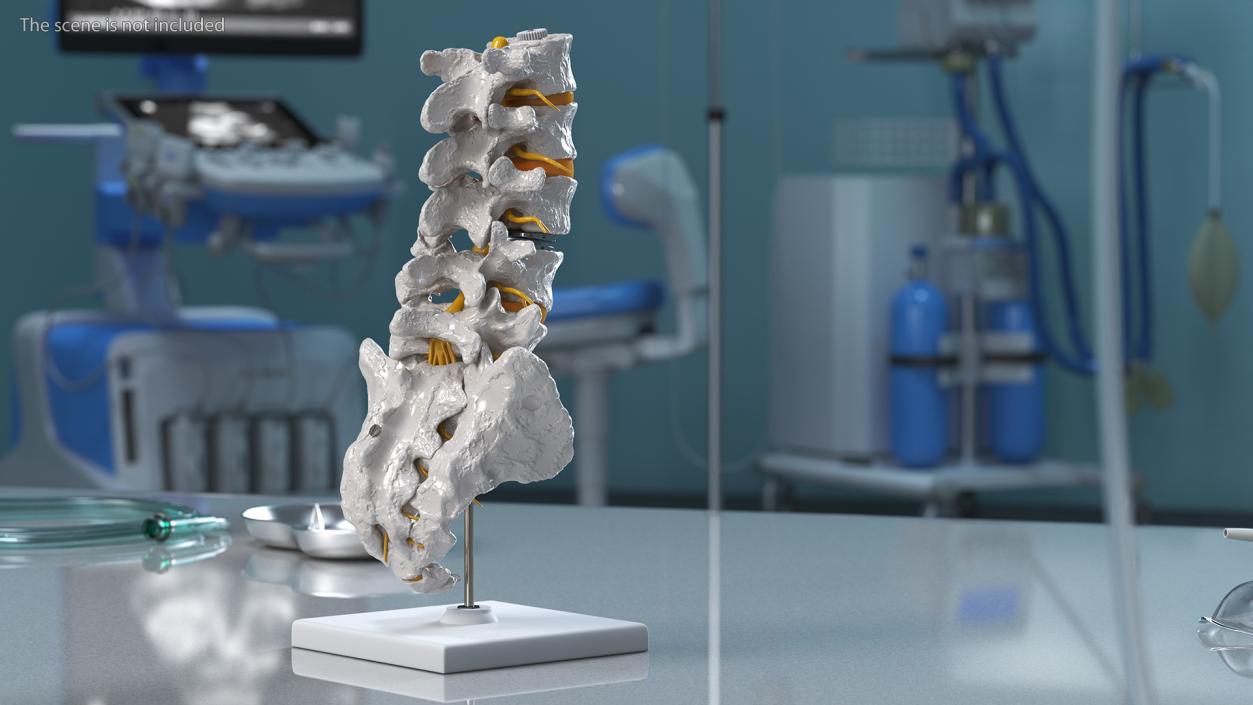 3D Intervertebral Disc Implant Installed on Spine 2 model