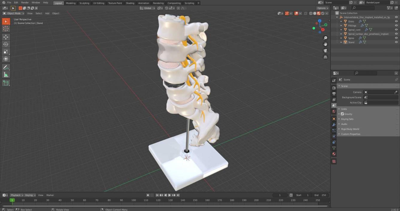 3D Intervertebral Disc Implant Installed on Spine 2 model