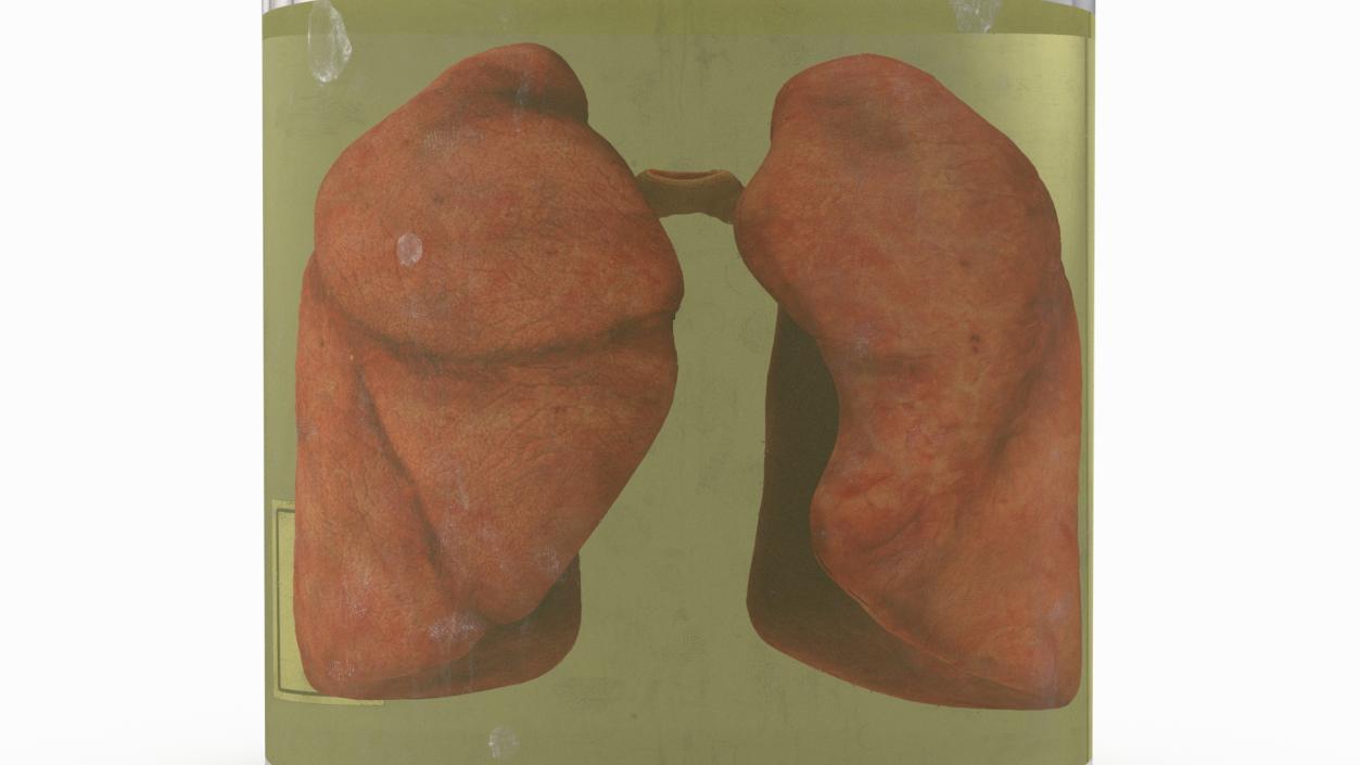 3D Human Lungs in Glass Jar 2