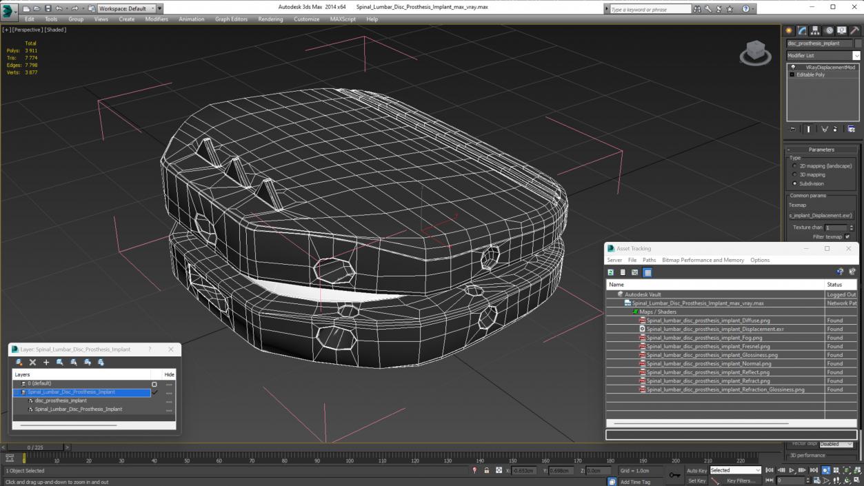 Spinal Lumbar Disc Prosthesis Implant 3D