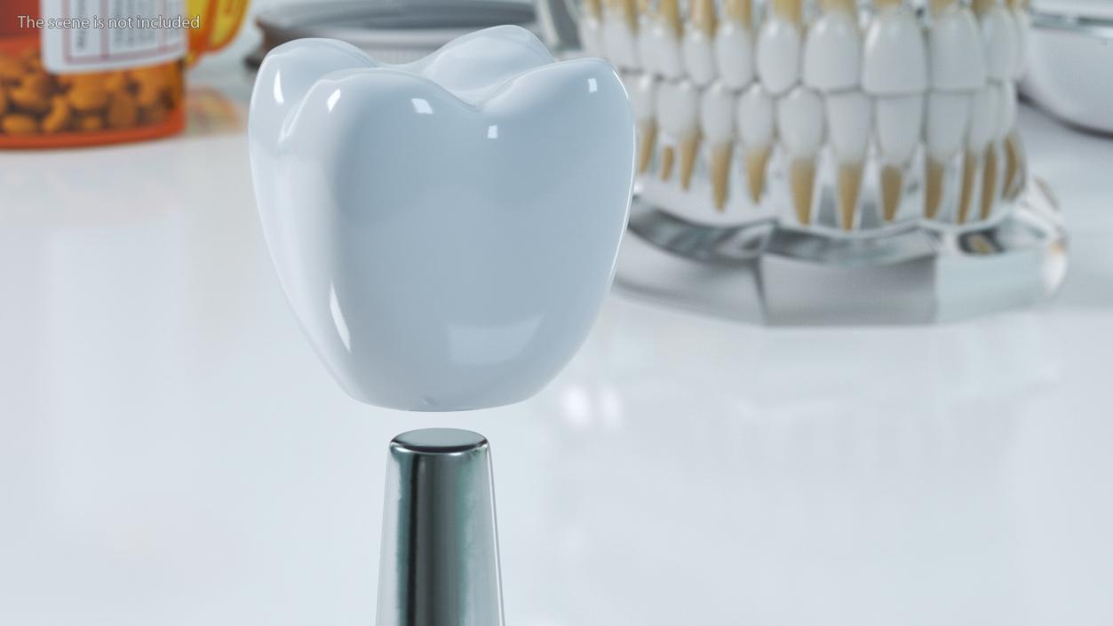 3D Dental Implants Collection