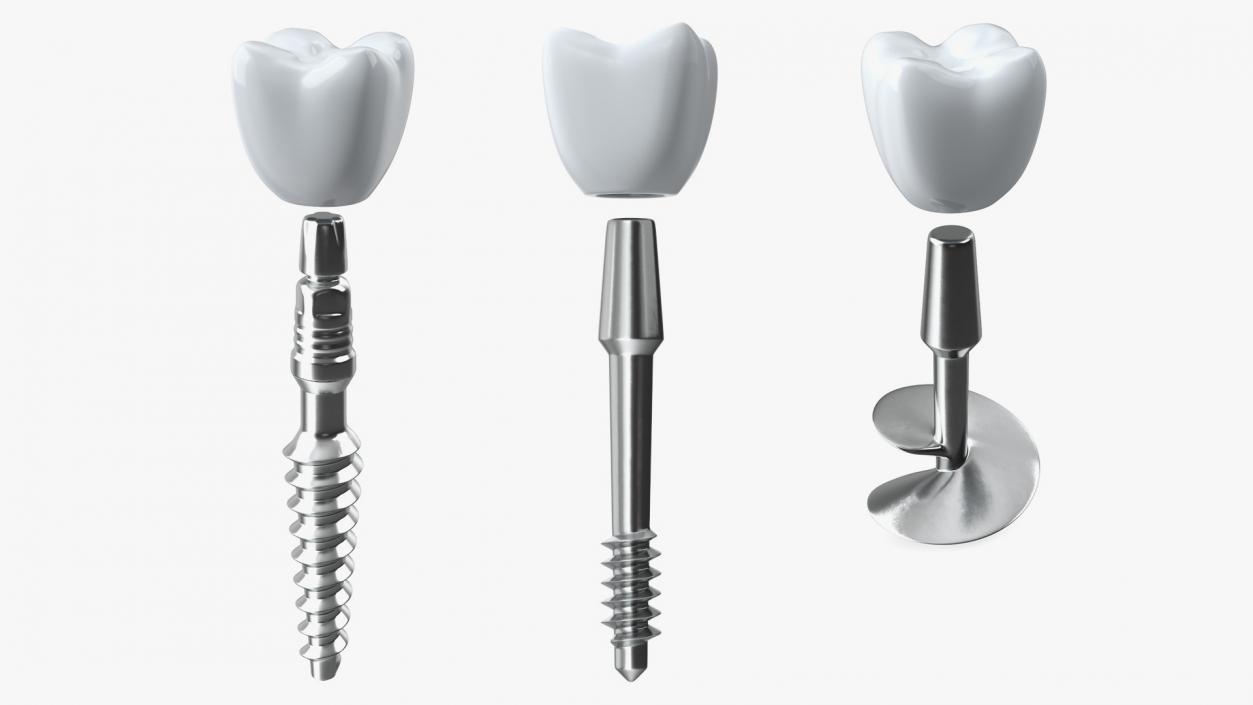 3D Dental Implants Collection