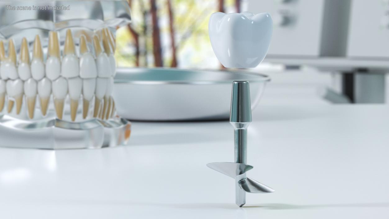 3D Dental Implants Collection