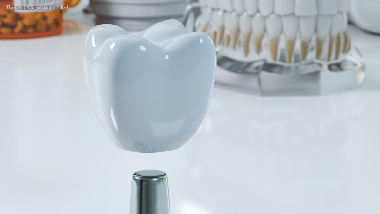 3D Dental Implants Collection