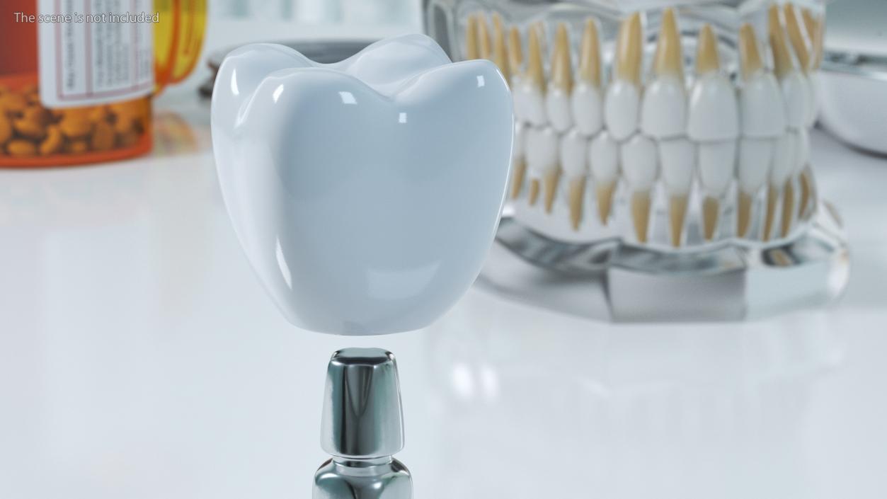 3D Dental Implants Collection