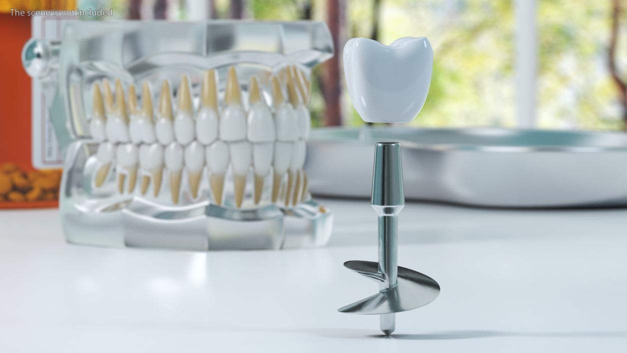 3D Dental Implants Collection