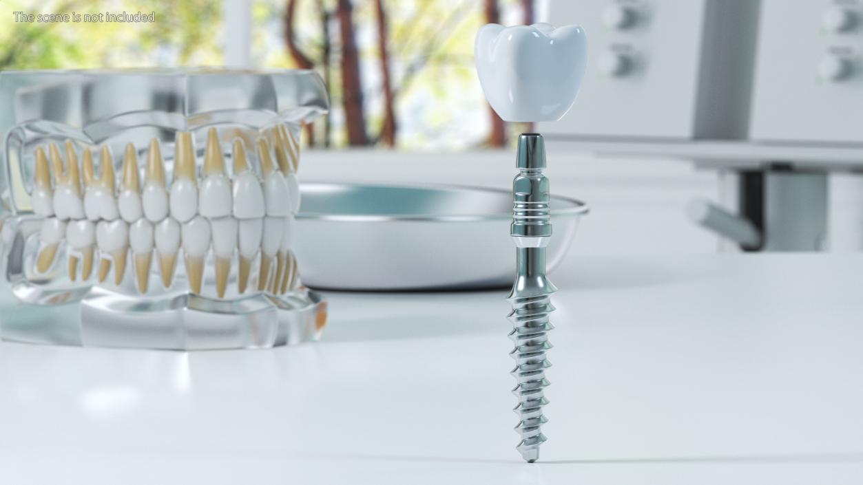 3D Dental Implants Collection