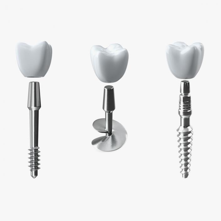 3D Dental Implants Collection