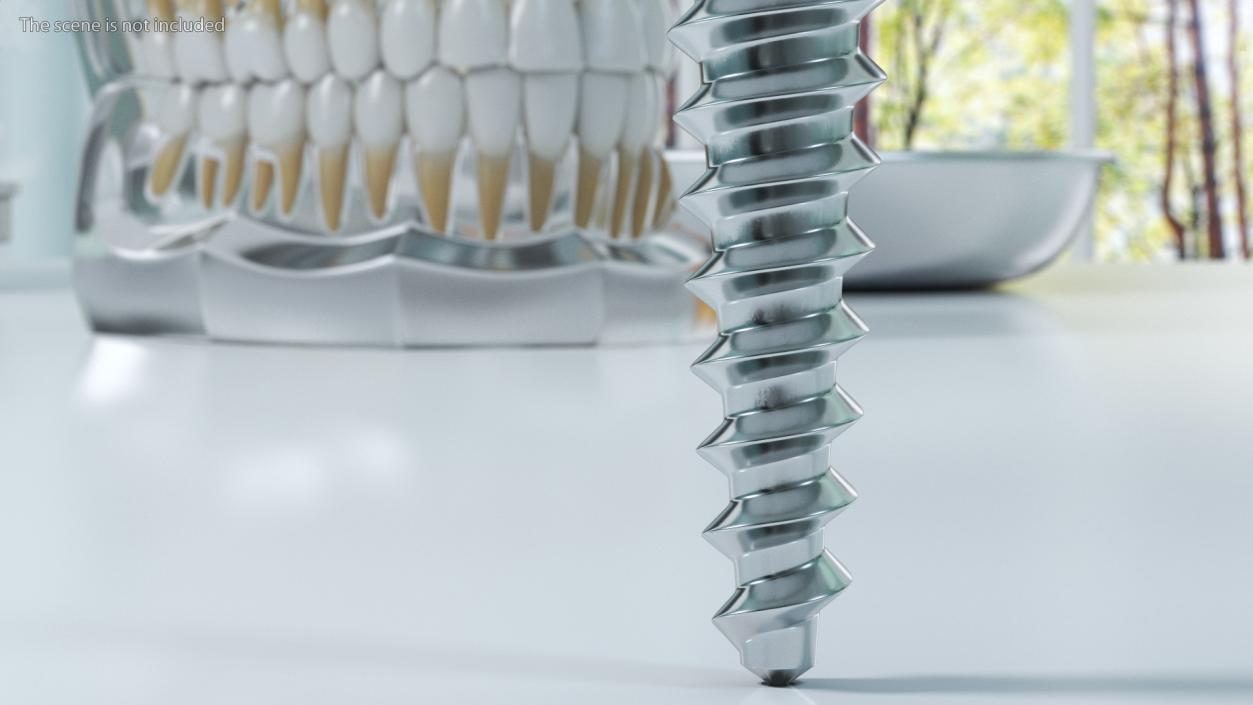 3D Dental Implants Collection