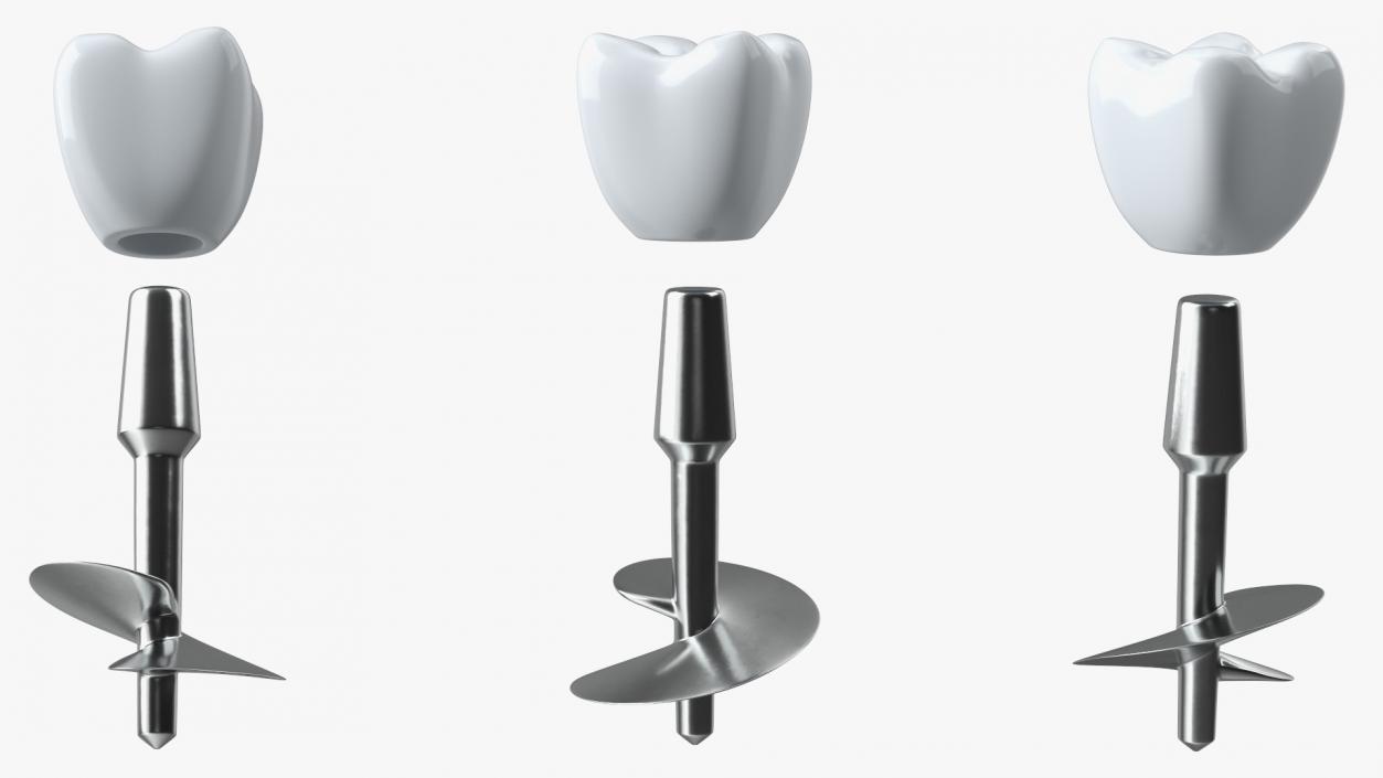 3D Dental Implants Collection