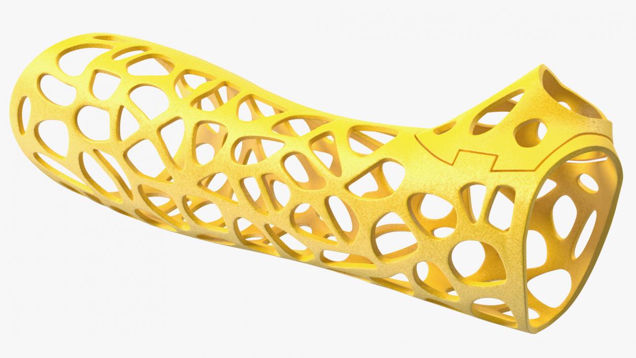 3D -Printed Orthopedic Cast Hand Yellow