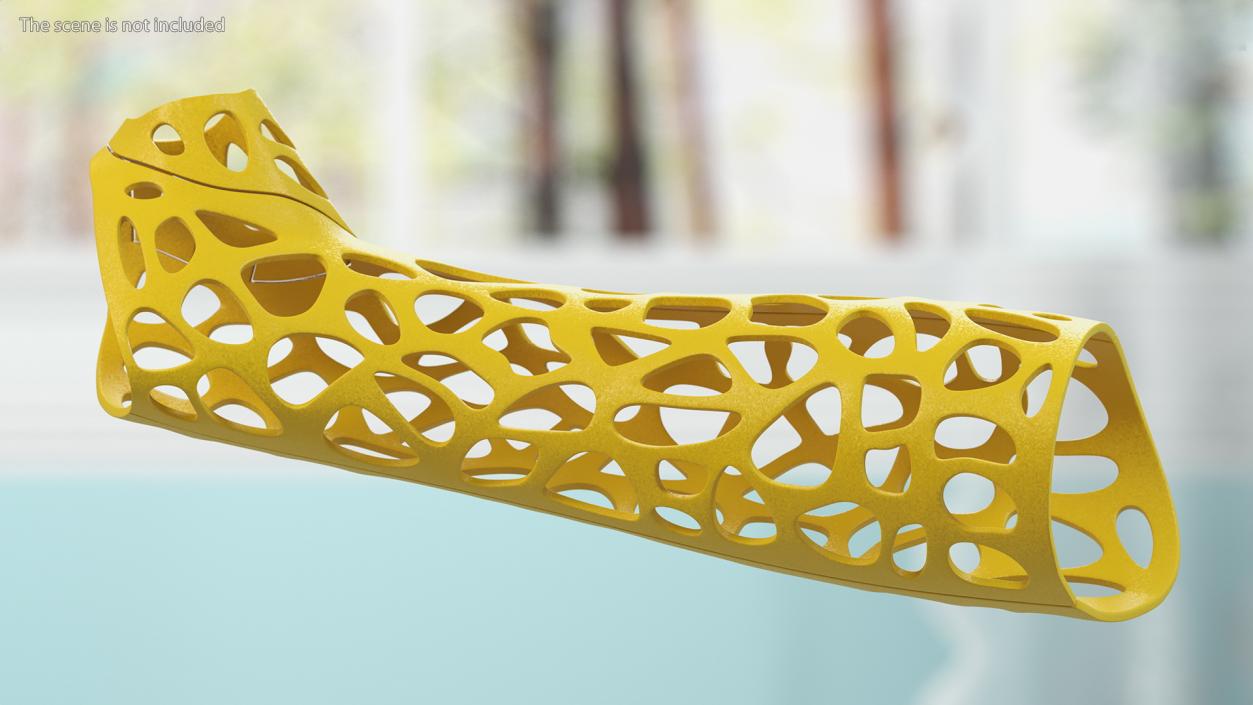 3D -Printed Orthopedic Cast Hand Yellow