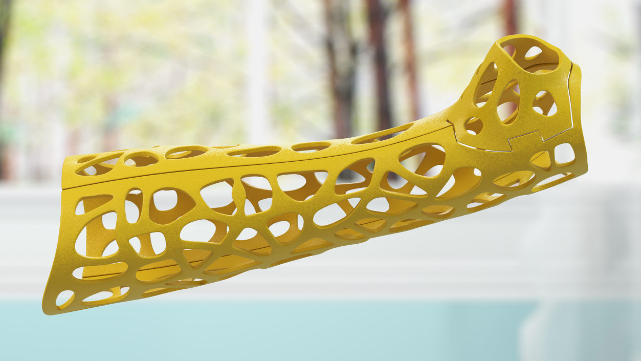 3D -Printed Orthopedic Cast Hand Yellow