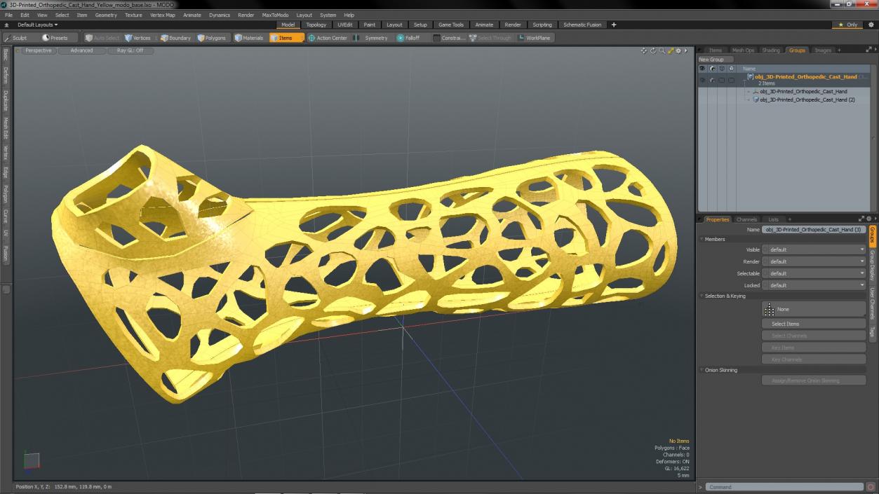 3D -Printed Orthopedic Cast Hand Yellow