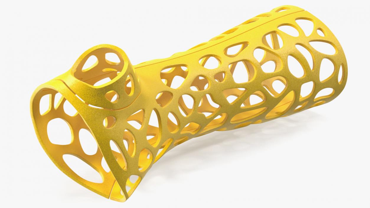 3D -Printed Orthopedic Cast Hand Yellow