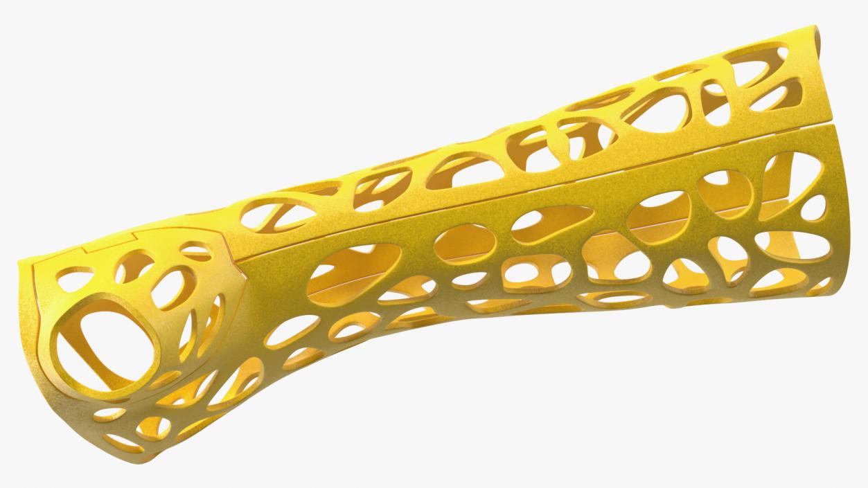 3D -Printed Orthopedic Cast Hand Yellow