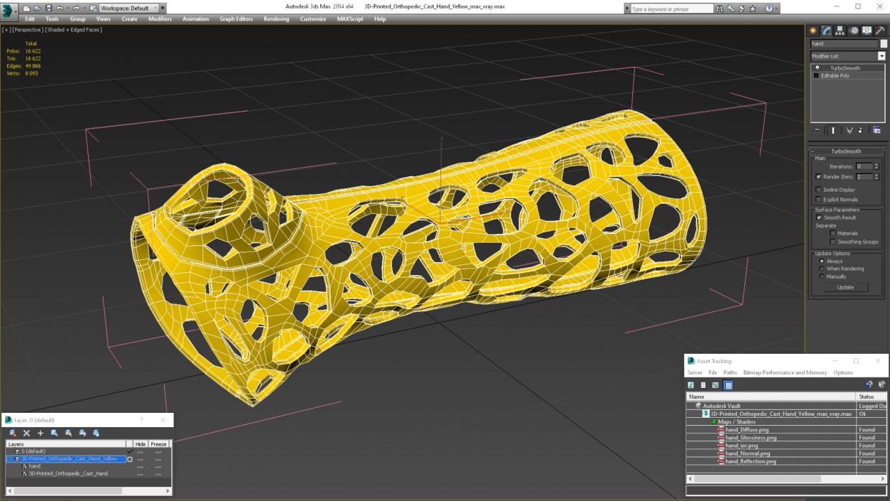 3D -Printed Orthopedic Cast Hand Yellow