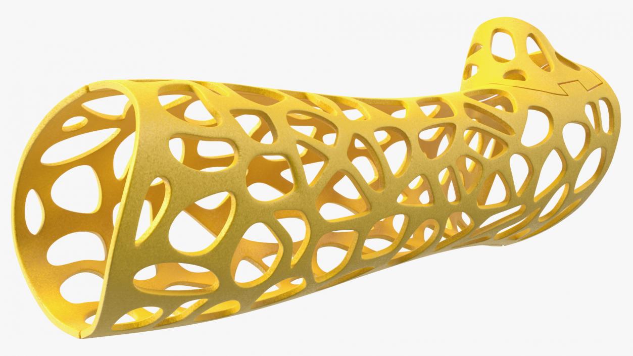 3D -Printed Orthopedic Cast Hand Yellow