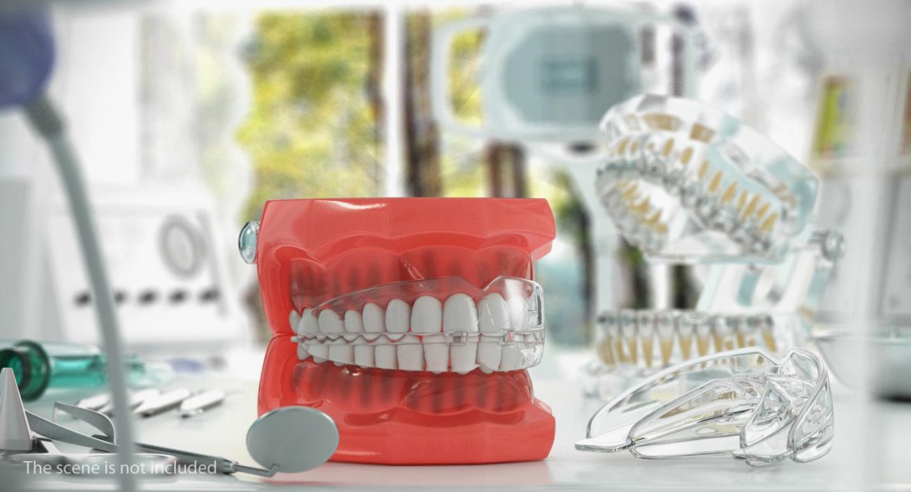 Orthodontic Teeth Braces 3D model