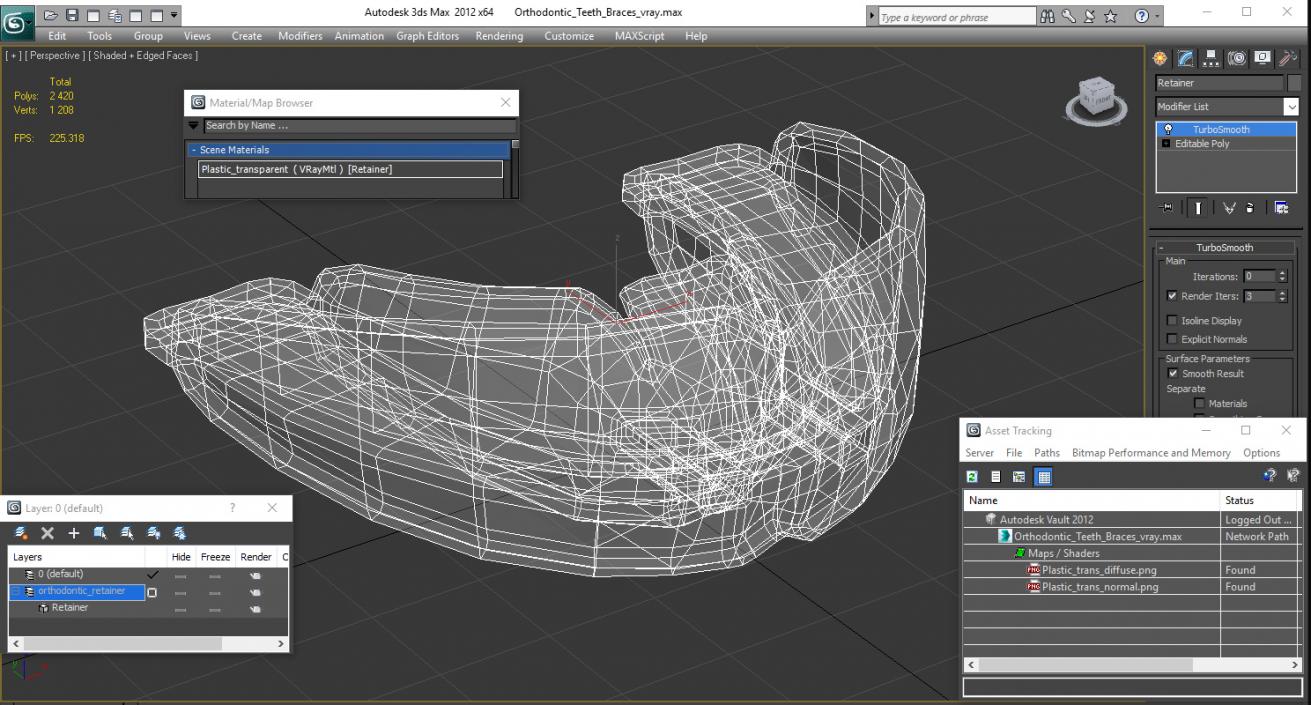 Orthodontic Teeth Braces 3D model