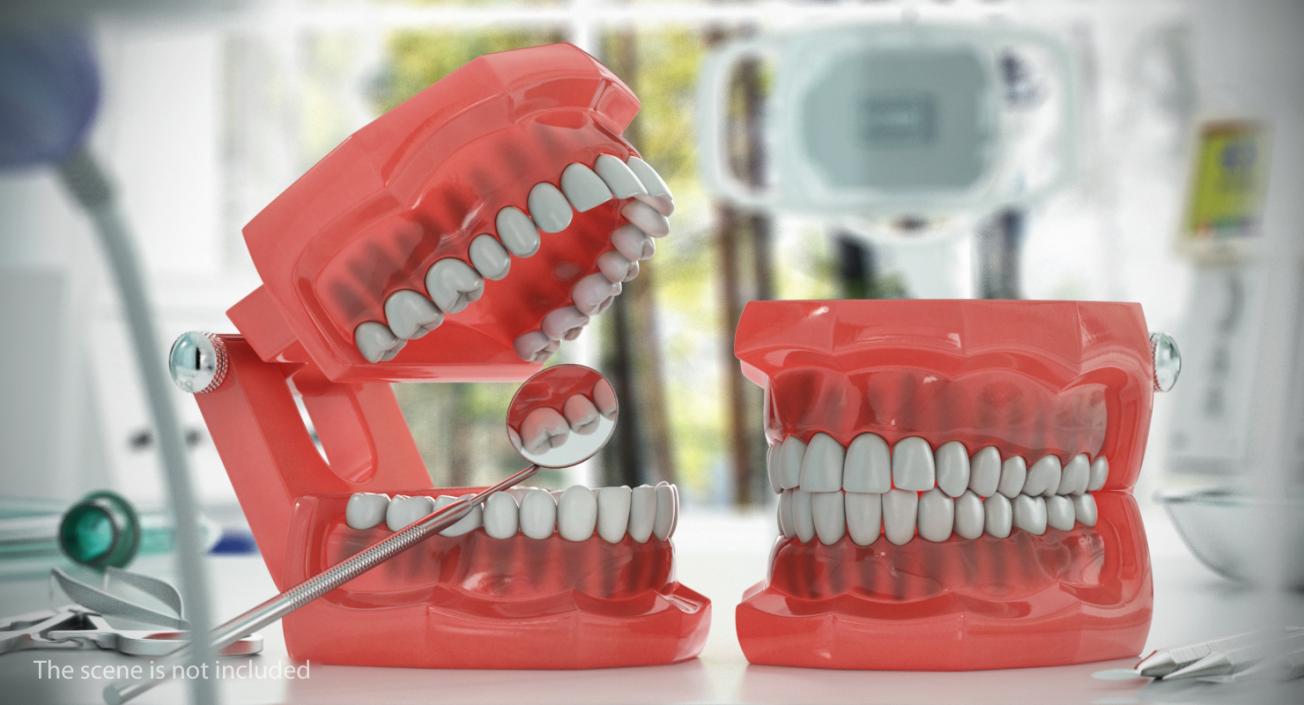 Typodont with Transparent Removable Retainer 3D model