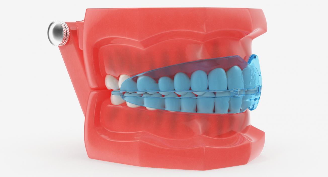 Typodont with Transparent Removable Retainer 3D model