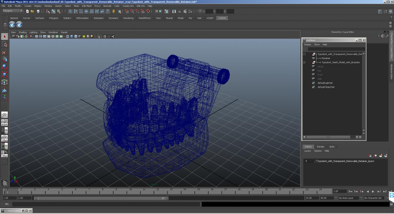 Typodont with Transparent Removable Retainer 3D model