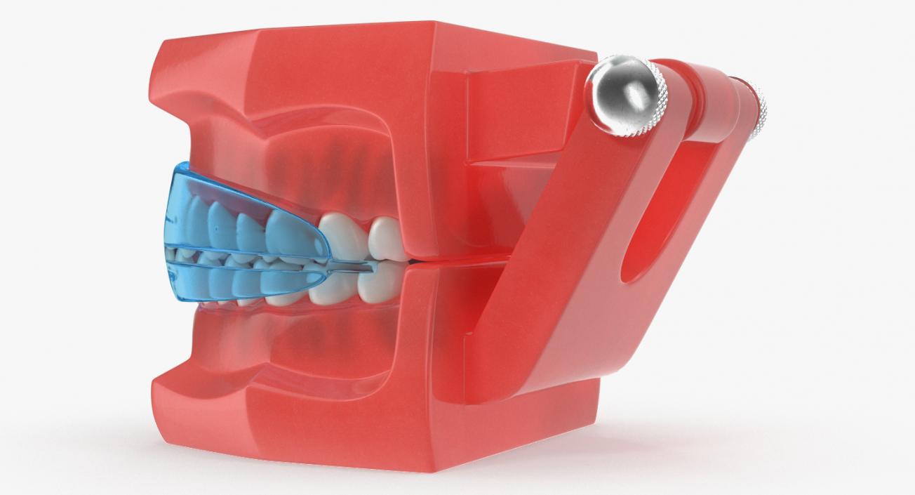 Typodont with Transparent Removable Retainer 3D model