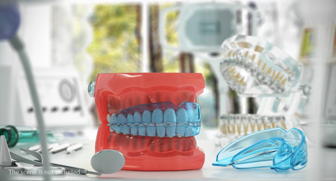 Typodont with Transparent Removable Retainer 3D model