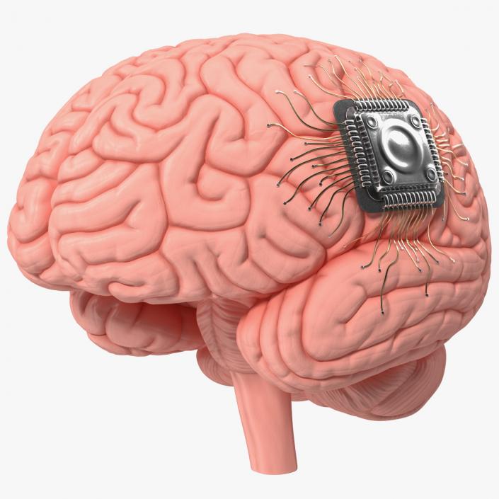 3D Human Brain with Implanted Microchip 2 model