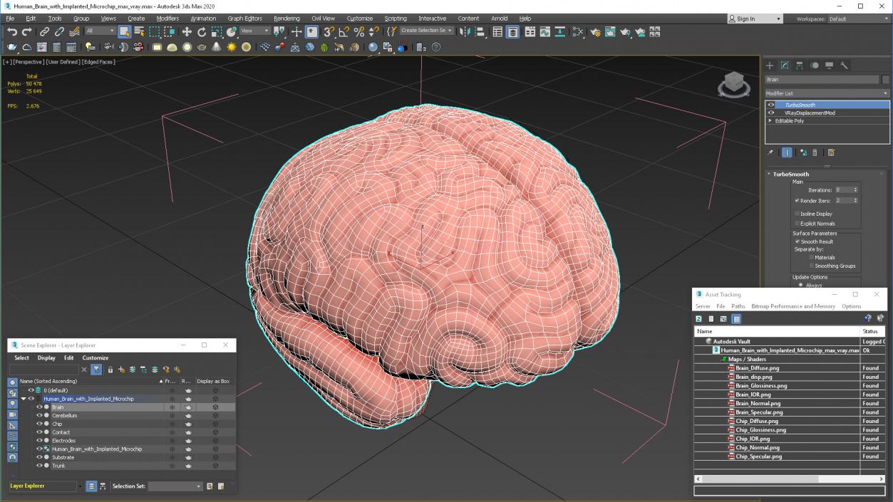 3D Human Brain with Implanted Microchip 2 model