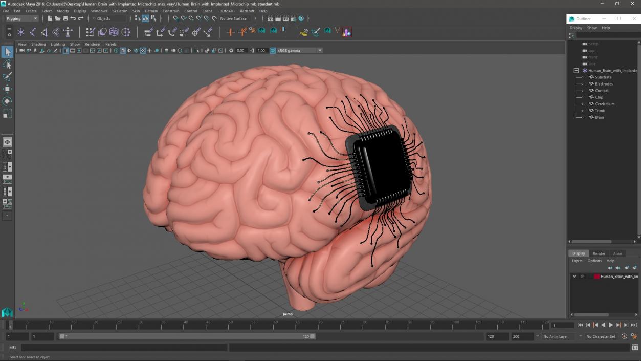 3D Human Brain with Implanted Microchip 2 model